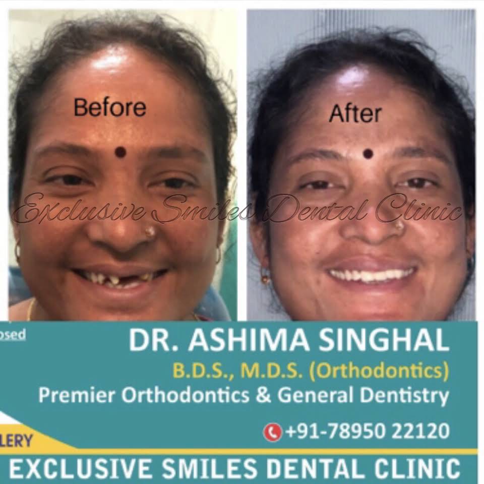 Exclusive Smiles Dental Clinic - Dr Ashima